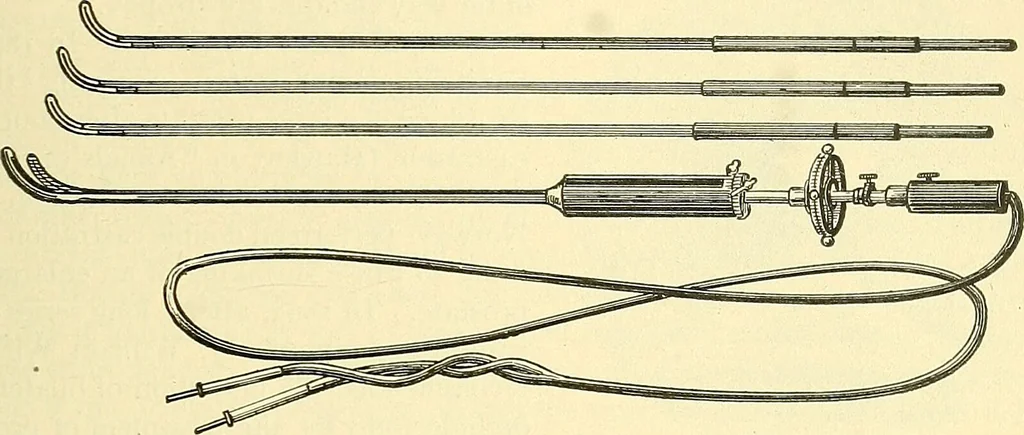 An illustration from Modern surgery, general and operative / by John Chalmers Da Costa., 1907, leaf 1219