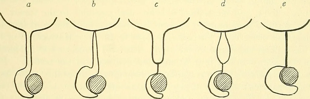 An illustration from Modern surgery, general and operative / by John Chalmers Da Costa., 1907, leaf 1227