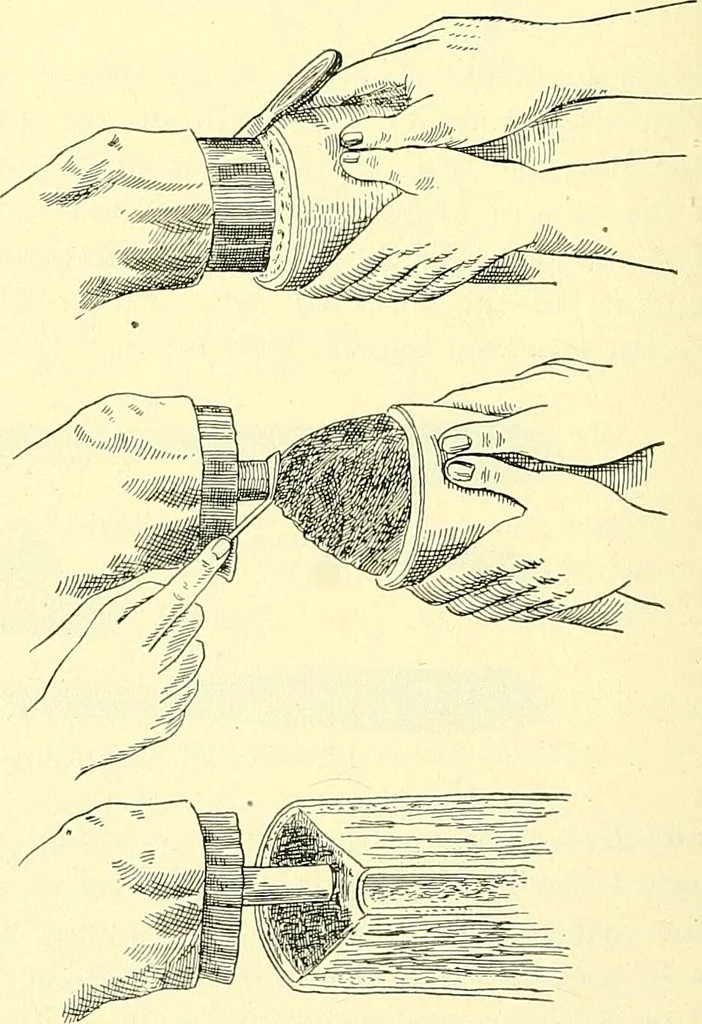 An illustration from Modern surgery, general and operative / by John Chalmers Da Costa., 1907, leaf 1232