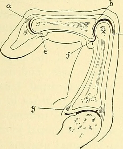 An illustration from Modern surgery, general and operative / by John Chalmers Da Costa., 1907, leaf 1235