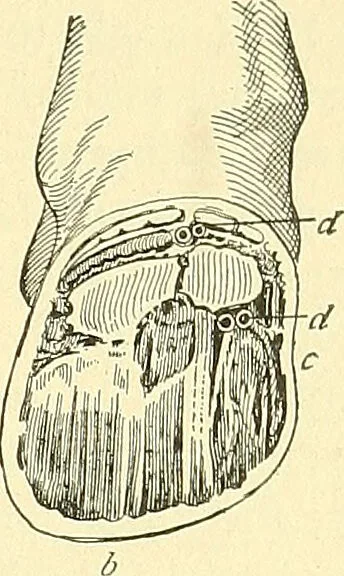 An illustration from Modern surgery, general and operative / by John Chalmers Da Costa., 1907, leaf 1243