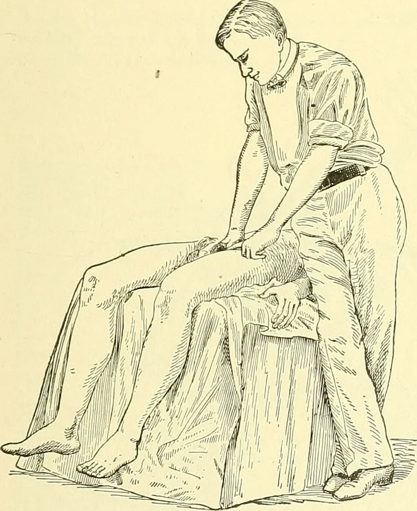 An illustration from Modern surgery, general and operative / by John Chalmers Da Costa., 1907, leaf 1249