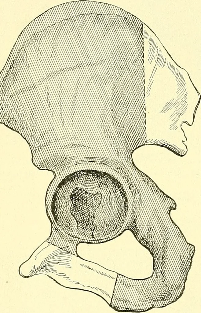 An illustration from Modern surgery, general and operative / by John Chalmers Da Costa., 1907, leaf 1252