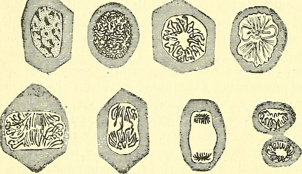 An illustration from Modern surgery, general and operative / by John Chalmers Da Costa., 1907, leaf 126