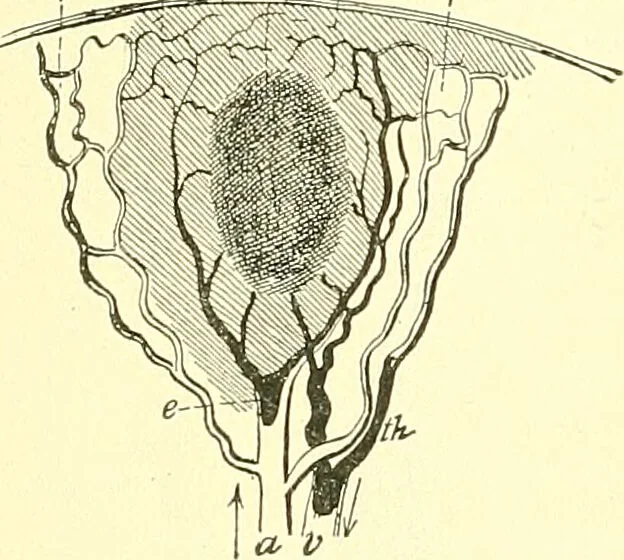 An illustration from Modern surgery, general and operative / by John Chalmers Da Costa., 1907, leaf 196