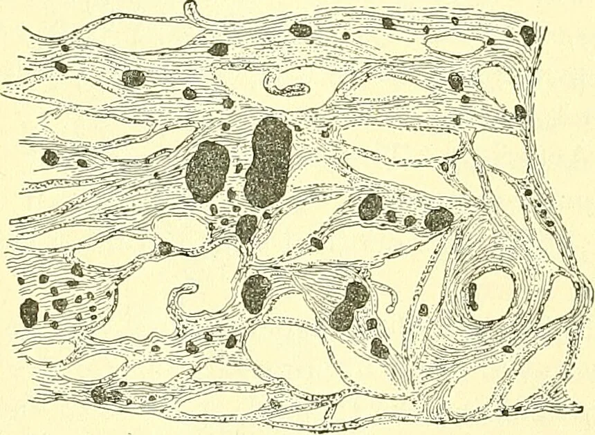 An illustration from Modern surgery, general and operative / by John Chalmers Da Costa., 1907, leaf 198