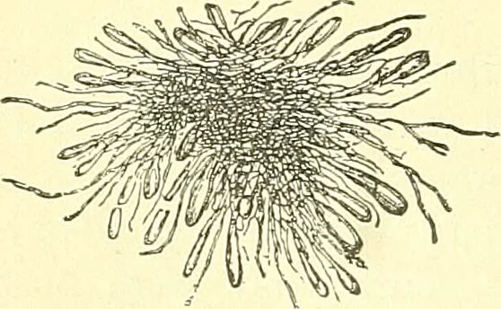 An illustration from Modern surgery, general and operative / by John Chalmers Da Costa., 1907, leaf 22