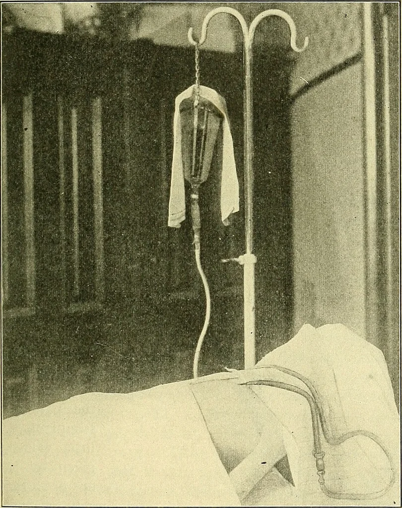 An illustration from Modern surgery, general and operative / by John Chalmers Da Costa., 1907, leaf 247
