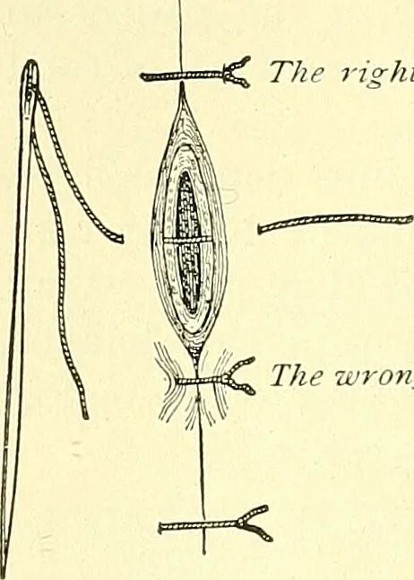 An illustration from Modern surgery, general and operative / by John Chalmers Da Costa., 1907, leaf 254