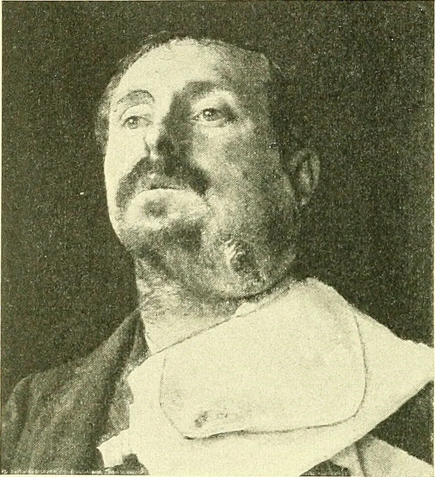 An illustration from Modern surgery, general and operative / by John Chalmers Da Costa., 1907, leaf 324
