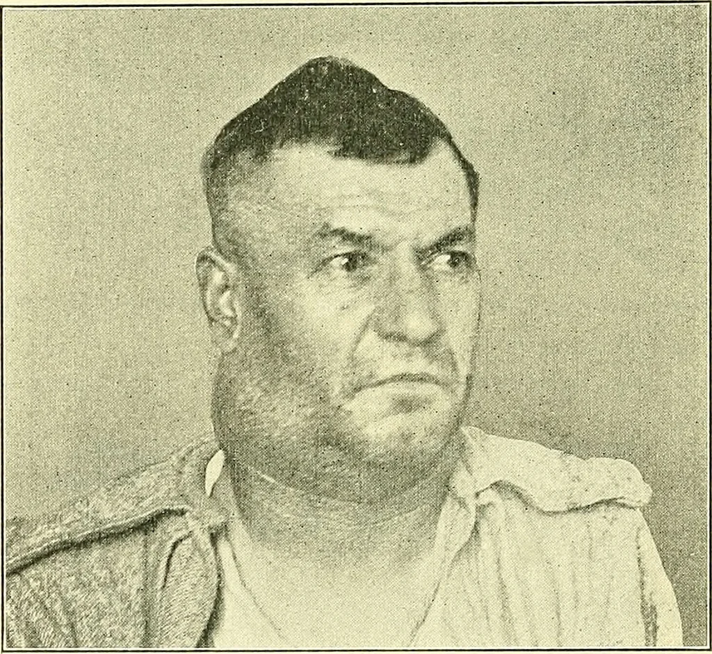 An illustration from Modern surgery, general and operative / by John Chalmers Da Costa., 1907, leaf 326