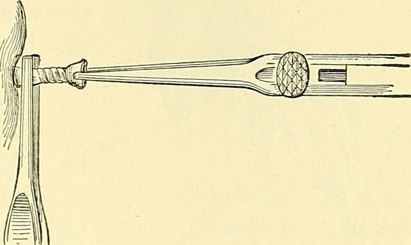 An illustration from Modern surgery, general and operative / by John Chalmers Da Costa., 1907, leaf 387