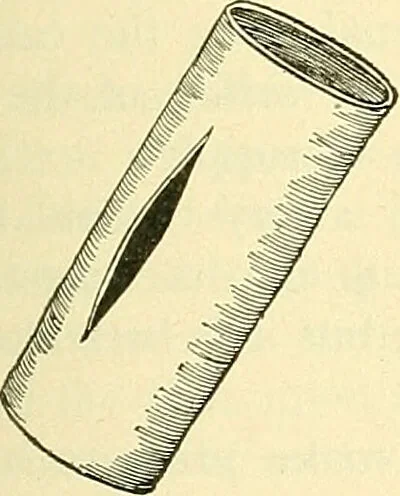 An illustration from Modern surgery, general and operative / by John Chalmers Da Costa., 1907, leaf 393
