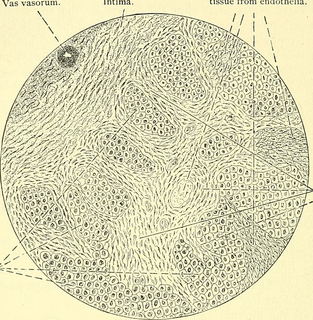 An illustration from Modern surgery, general and operative / by John Chalmers Da Costa., 1907, leaf 410