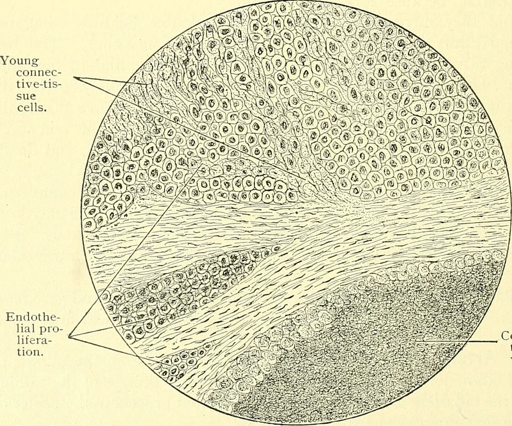An illustration from Modern surgery, general and operative / by John Chalmers Da Costa., 1907, leaf 410