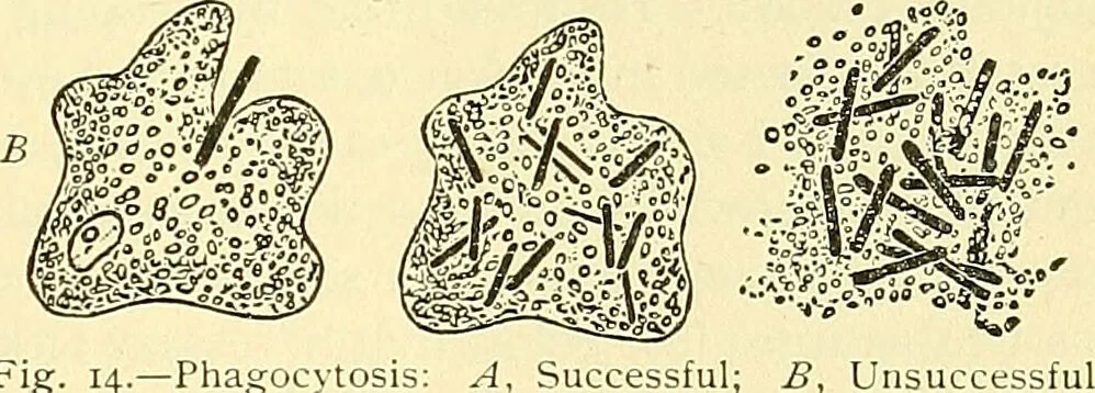 An illustration from Modern surgery, general and operative / by John Chalmers Da Costa., 1907, leaf 43