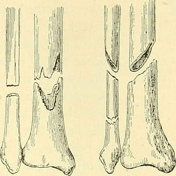 An illustration from Modern surgery, general and operative / by John Chalmers Da Costa., 1907, leaf 461