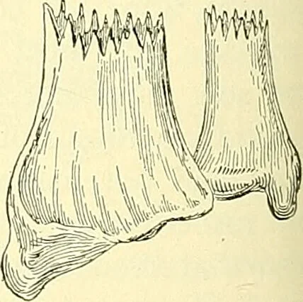 An illustration from Modern surgery, general and operative / by John Chalmers Da Costa., 1907, leaf 462