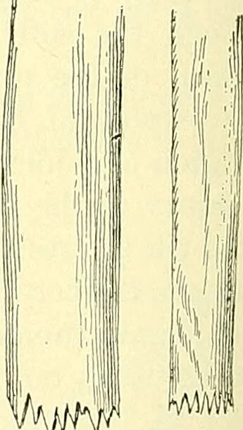 An illustration from Modern surgery, general and operative / by John Chalmers Da Costa., 1907, leaf 462