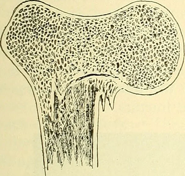 An illustration from Modern surgery, general and operative / by John Chalmers Da Costa., 1907, leaf 463