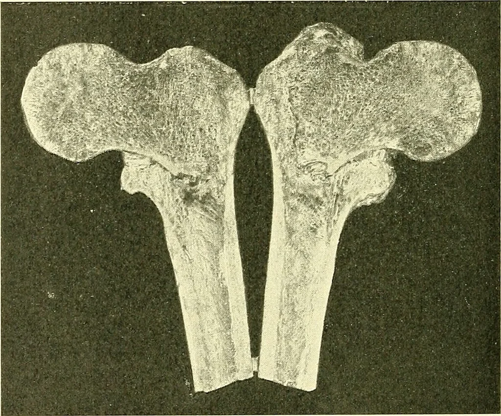 An illustration from Modern surgery, general and operative / by John Chalmers Da Costa., 1907, leaf 464
