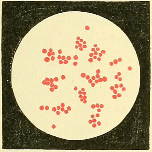 An illustration from Modern surgery, general and operative / by John Chalmers Da Costa., 1907, leaf 47