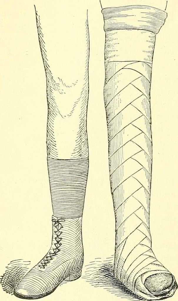 An illustration from Modern surgery, general and operative / by John Chalmers Da Costa., 1907, leaf 476
