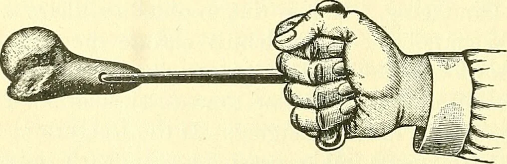 An illustration from Modern surgery, general and operative / by John Chalmers Da Costa., 1907, leaf 478