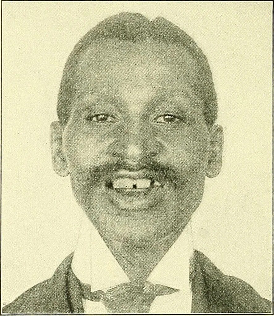 An illustration from Modern surgery, general and operative / by John Chalmers Da Costa., 1907, leaf 486