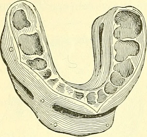 An illustration from Modern surgery, general and operative / by John Chalmers Da Costa., 1907, leaf 488