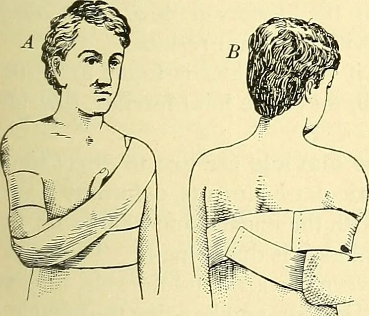 An illustration from Modern surgery, general and operative / by John Chalmers Da Costa., 1907, leaf 497
