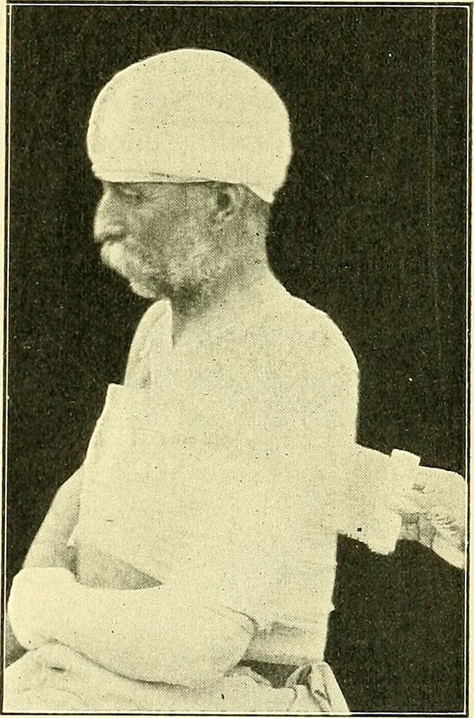 An illustration from Modern surgery, general and operative / by John Chalmers Da Costa., 1907, leaf 503