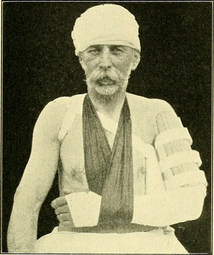 An illustration from Modern surgery, general and operative / by John Chalmers Da Costa., 1907, leaf 507