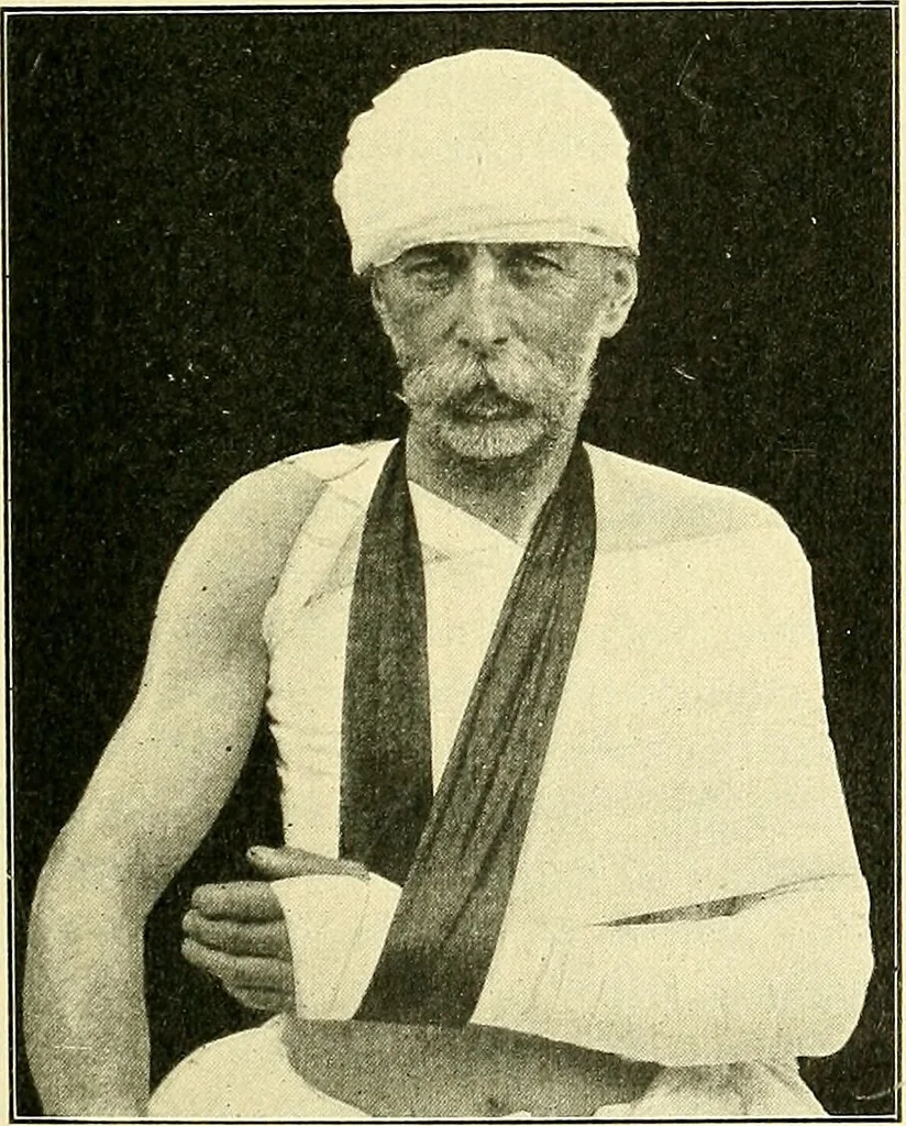 An illustration from Modern surgery, general and operative / by John Chalmers Da Costa., 1907, leaf 507