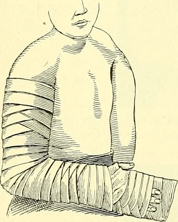 An illustration from Modern surgery, general and operative / by John Chalmers Da Costa., 1907, leaf 508