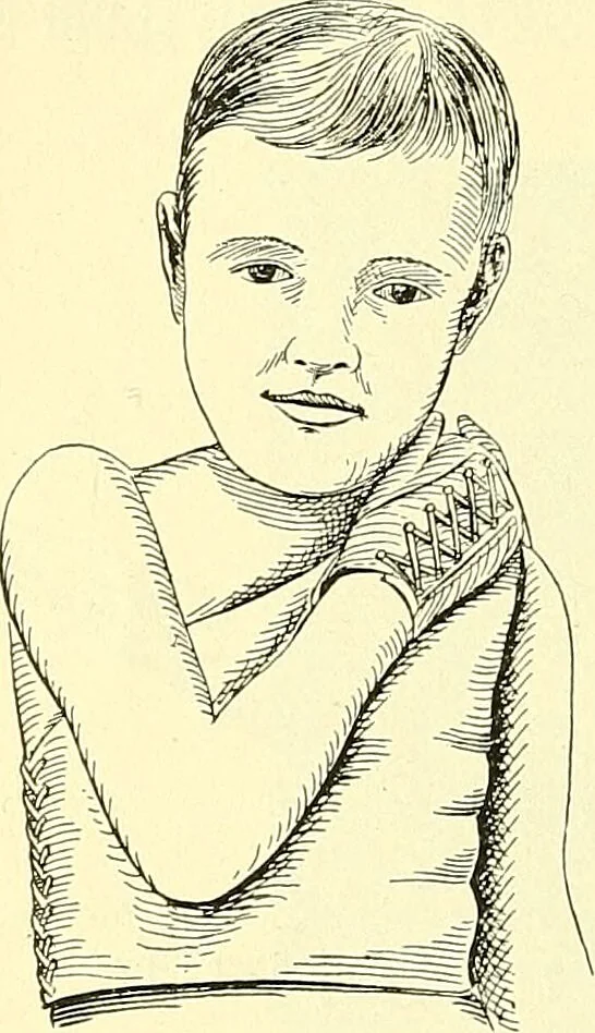 An illustration from Modern surgery, general and operative / by John Chalmers Da Costa., 1907, leaf 514