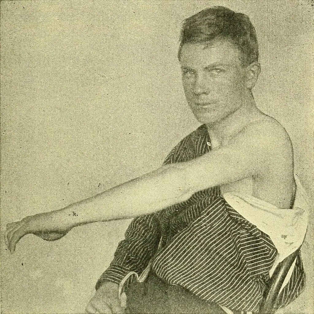 An illustration from Modern surgery, general and operative / by John Chalmers Da Costa., 1907, leaf 517
