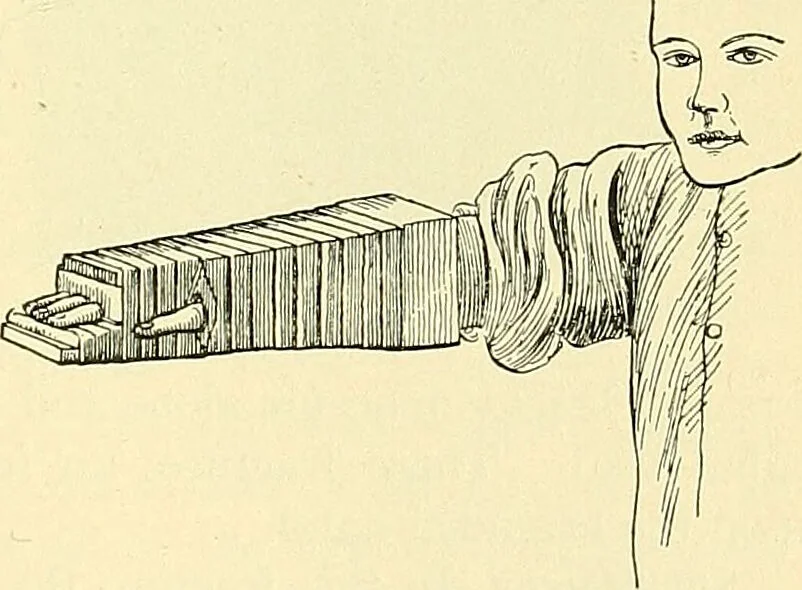 An illustration from Modern surgery, general and operative / by John Chalmers Da Costa., 1907, leaf 519