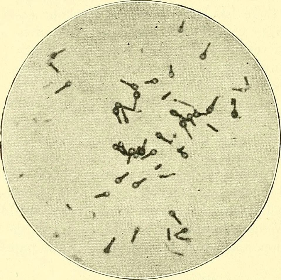 An illustration from Modern surgery, general and operative / by John Chalmers Da Costa., 1907, leaf 52