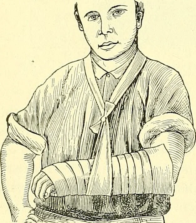 An illustration from Modern surgery, general and operative / by John Chalmers Da Costa., 1907, leaf 524
