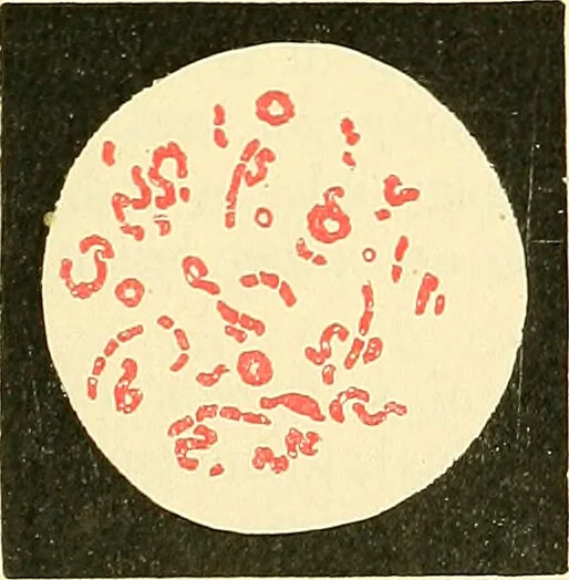 An illustration from Modern surgery, general and operative / by John Chalmers Da Costa., 1907, leaf 53