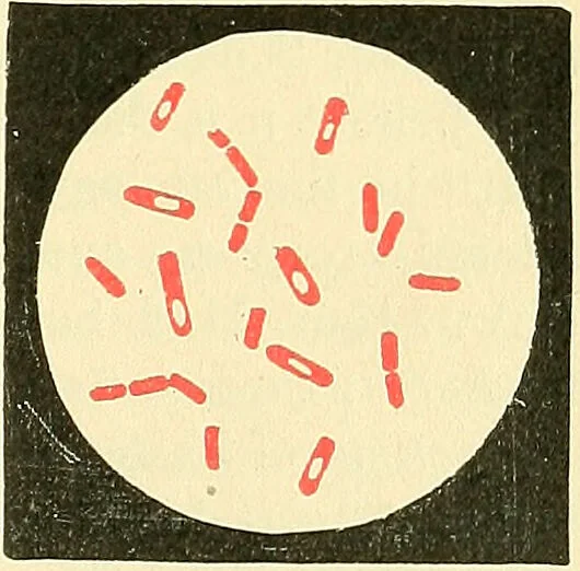 An illustration from Modern surgery, general and operative / by John Chalmers Da Costa., 1907, leaf 53