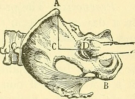An illustration from Modern surgery, general and operative / by John Chalmers Da Costa., 1907, leaf 531
