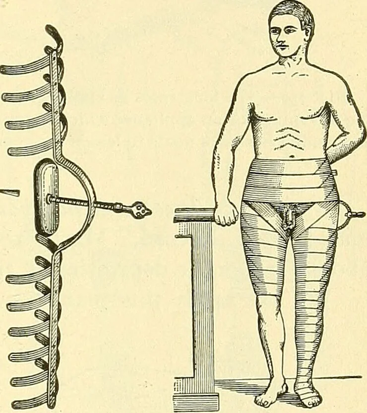 An illustration from Modern surgery, general and operative / by John Chalmers Da Costa., 1907, leaf 535