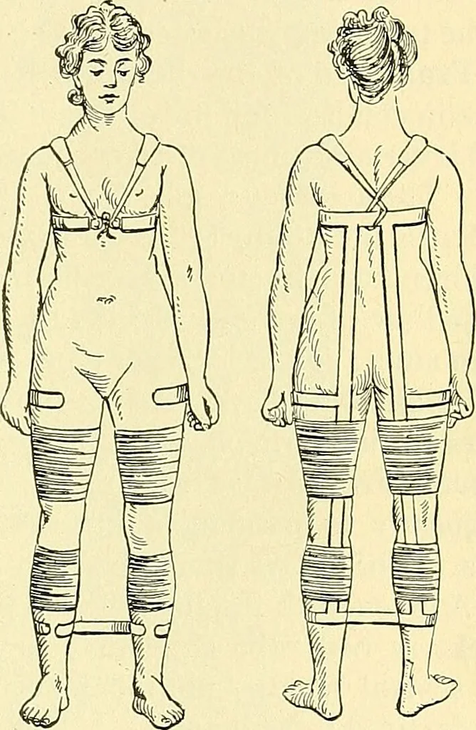 An illustration from Modern surgery, general and operative / by John Chalmers Da Costa., 1907, leaf 537