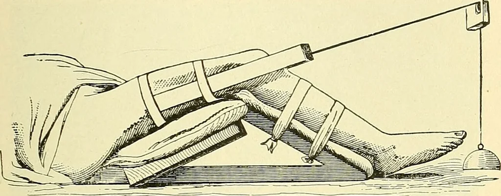 An illustration from Modern surgery, general and operative / by John Chalmers Da Costa., 1907, leaf 541