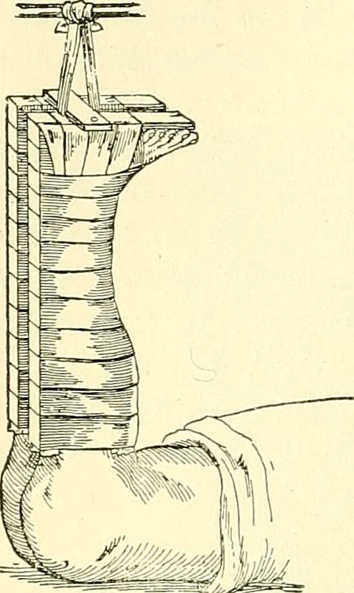 An illustration from Modern surgery, general and operative / by John Chalmers Da Costa., 1907, leaf 544