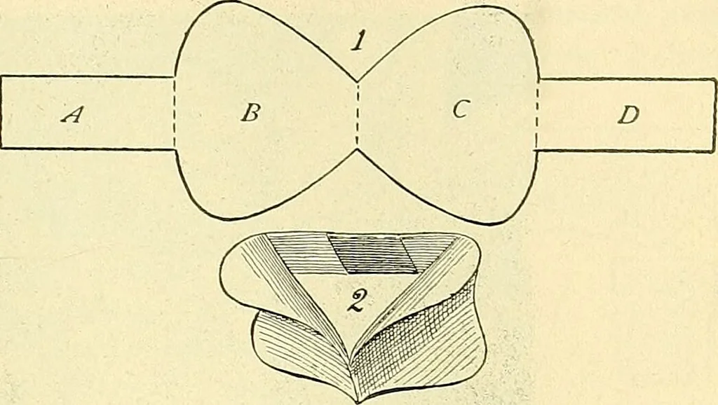An illustration from Modern surgery, general and operative / by John Chalmers Da Costa., 1907, leaf 545
