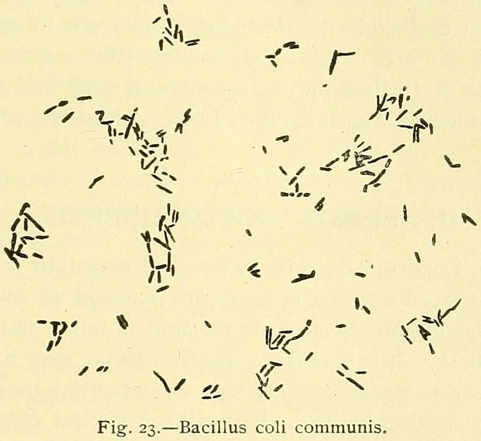 An illustration from Modern surgery, general and operative / by John Chalmers Da Costa., 1907, leaf 55