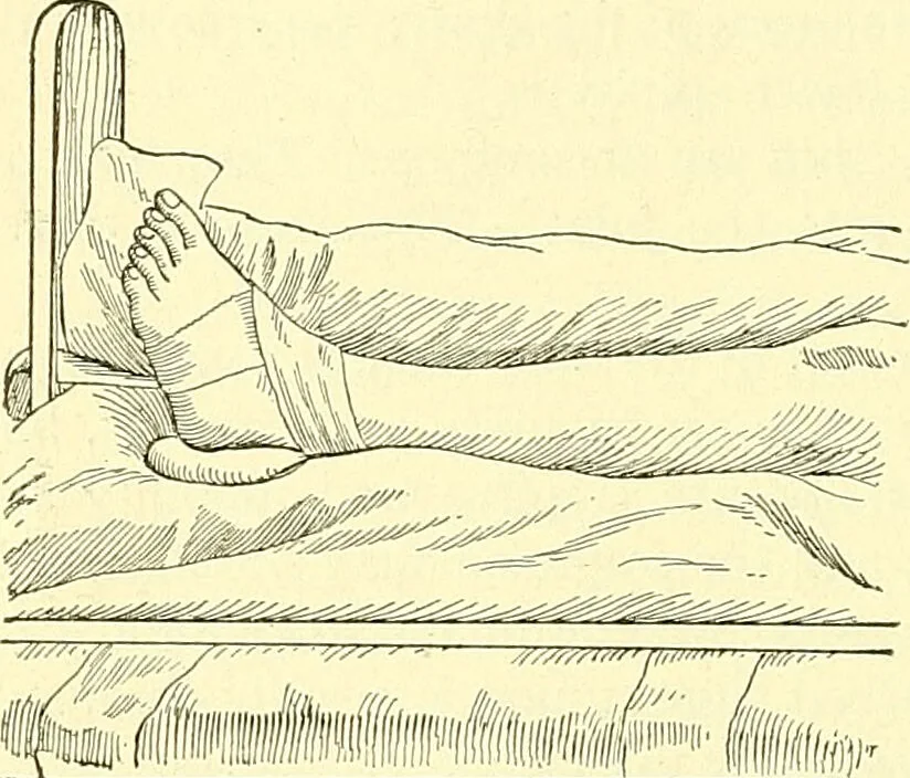 An illustration from Modern surgery, general and operative / by John Chalmers Da Costa., 1907, leaf 556
